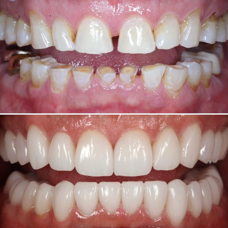 Before After Photo 1