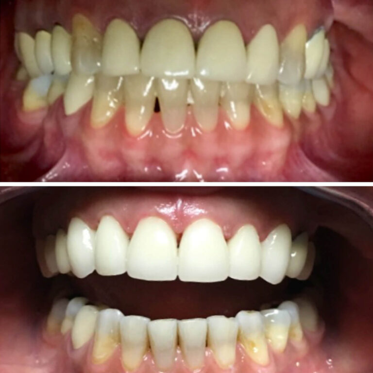 Before After Photo 10