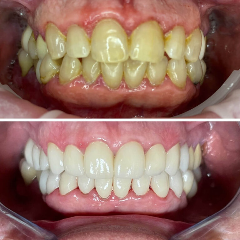 Before After Photo 3