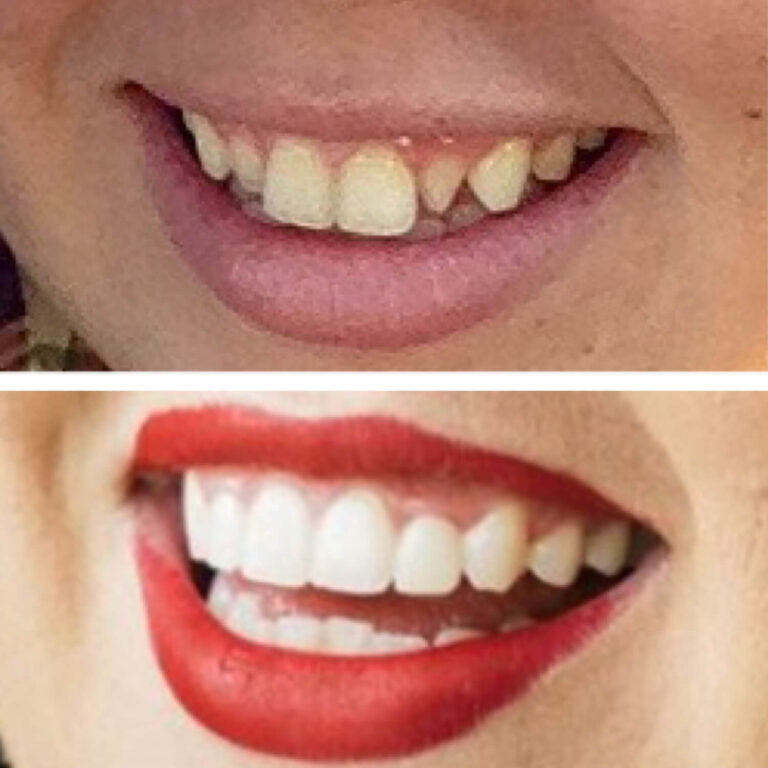 Before After Photo 5