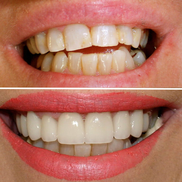 Before After Photo 6