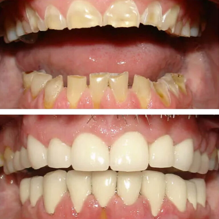 Before After Photo 7