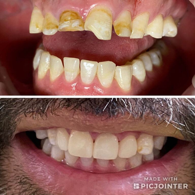 Before After Photo 8