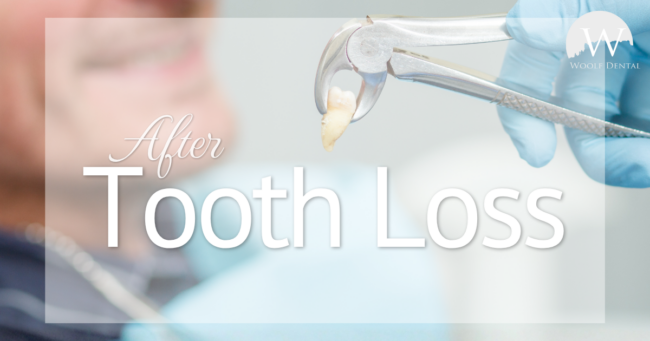 After Tooth Loss
