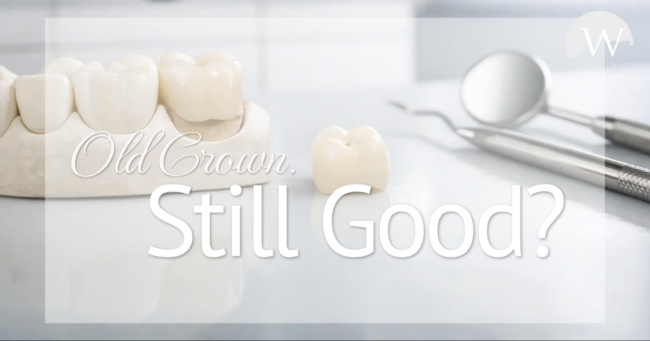 Old Crown Still Good? dental crowns