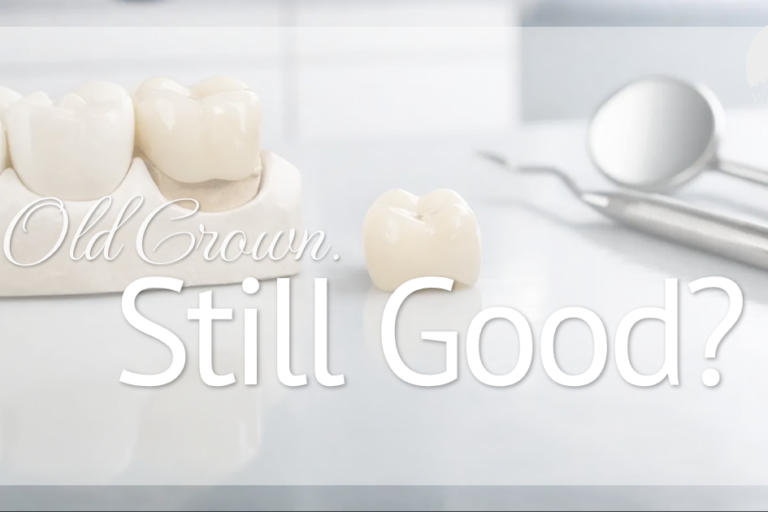 dental crowns